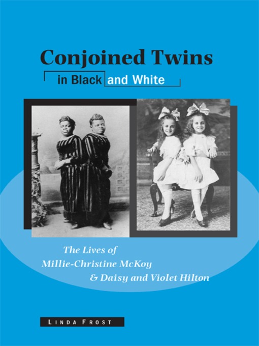 Title details for Conjoined Twins in Black and White by Linda Frost - Available